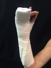Load image into Gallery viewer, Boxers Splint Kit